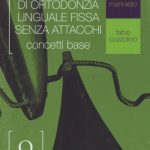 Atlante di ortodonzia linguale fissa senza attacchi