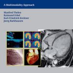 Cardiac Imaging - A Multimodality Approach