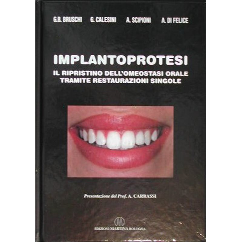 Implantoprotesi