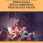 L'osteotomia distale percutanea nella chirurgia dell'alluce valgo