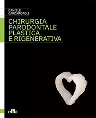 Chirurgia parodontale plastica e rigenerativa