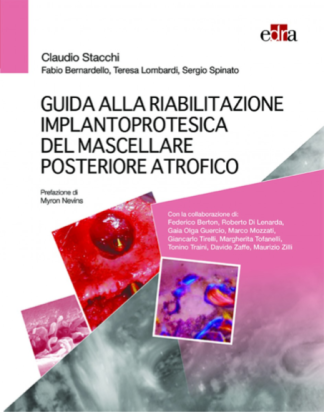 Guida alla riabilitazione implantoprotesica del mascellare posteriore atrofico