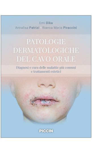 Patologie Dermatologiche del Cavo Orale