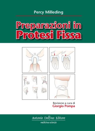 Preparazioni in Protesi Fissa