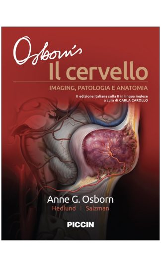 Il cervello. Imaging patologia e anatomia