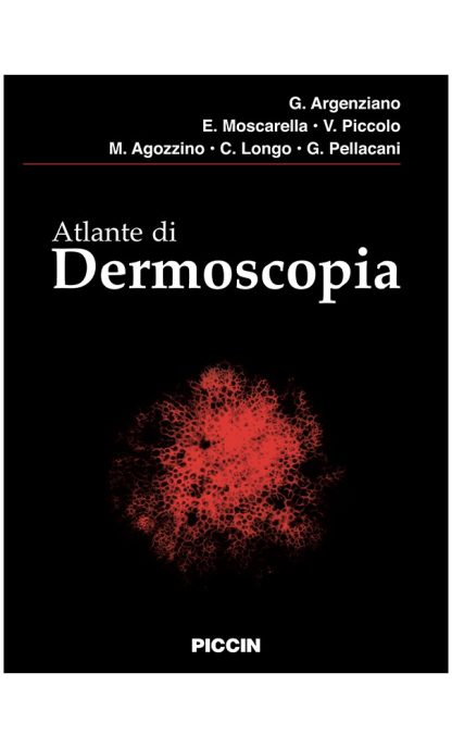 Atlante di Dermoscopia