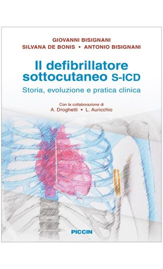 Il defribillatore sottocutaneo S-ICD