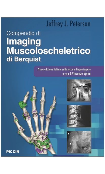 Imaging Muscoloscheletrico di Berquist